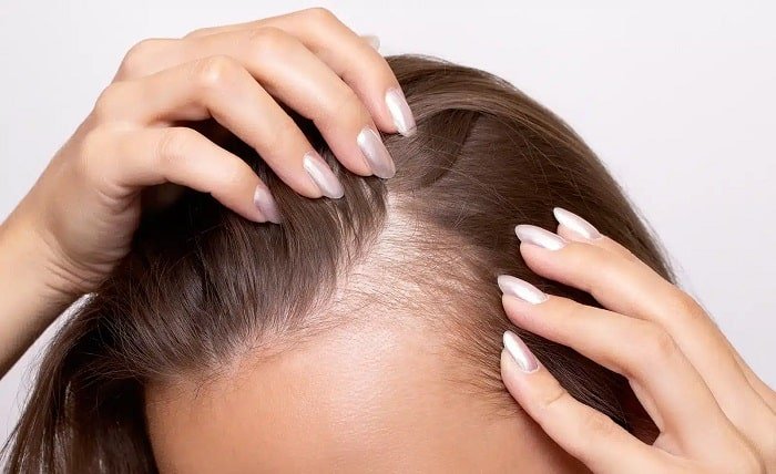 Thinning Hair