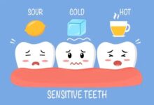 tooth sensitivity treatment
